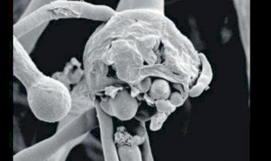 ಜಿಲ್ಲೆಯಲ್ಲಿ ಮೂರು Black fungus ಪ್ರಕರಣ: ಕಟ್ಟುನಿಟ್ಟಿನ ಕ್ರಮಕ್ಕೆ ಡಿಸಿ‌ ಸೂಚನೆ